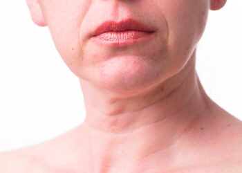 Arrugas en el cuello: Cómo tratarlas