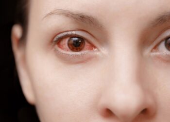 enfermedades del ojo